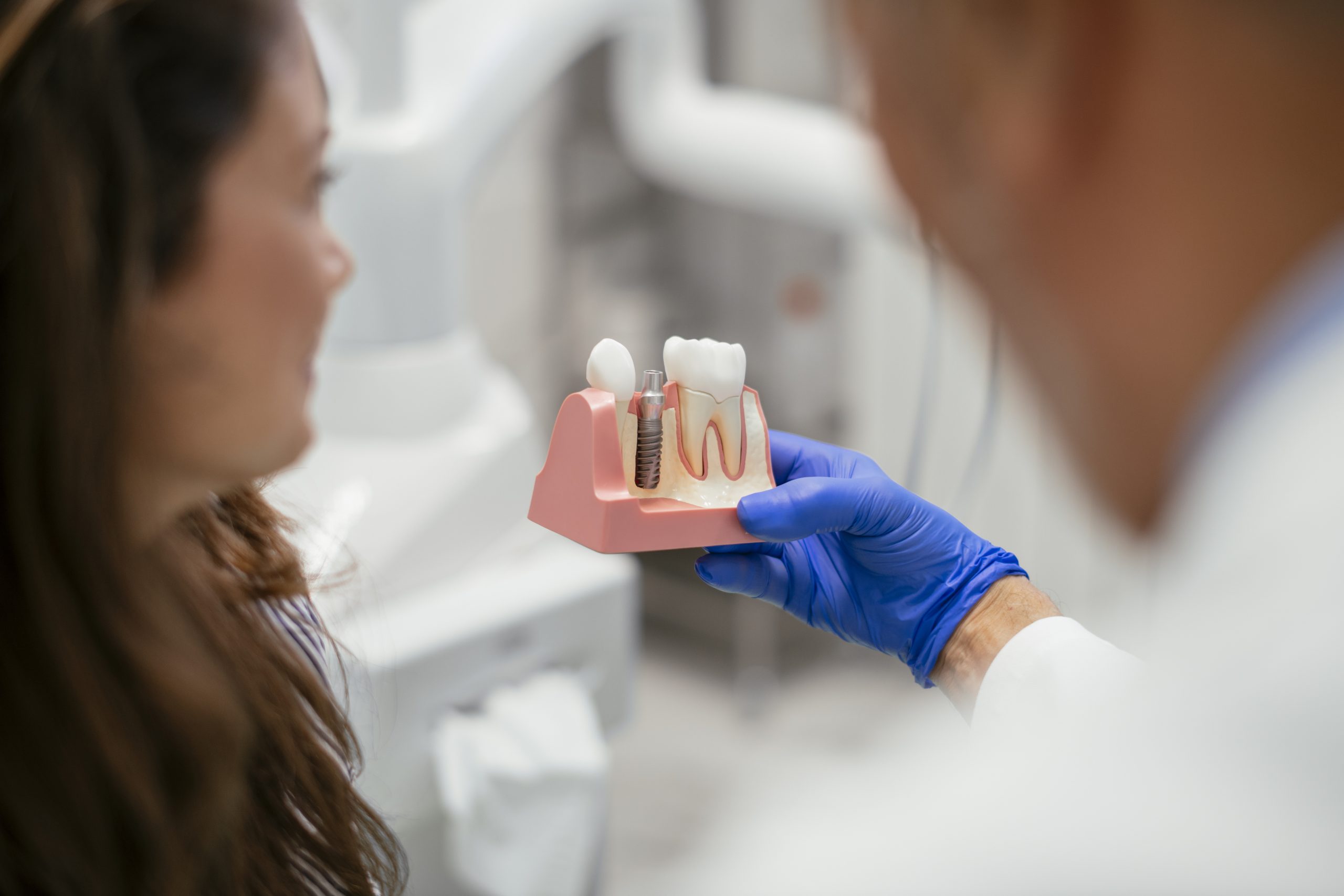 ventajas de los implantes dentales